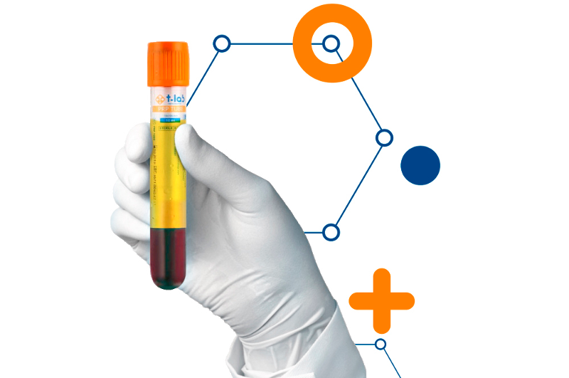 PRP -терапия T-lab